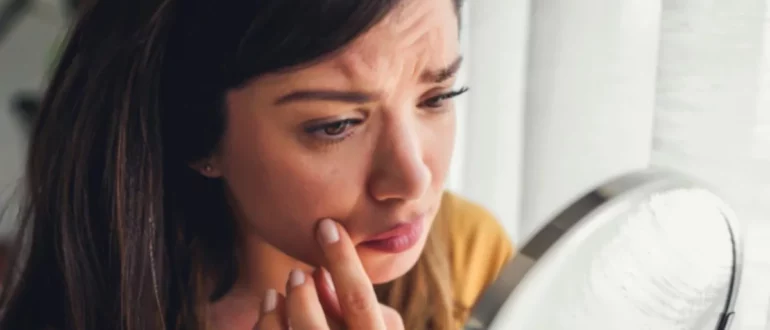 mujer preocupada mirando en el espejo cáncer de piel